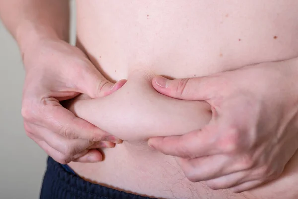 Hombre Mano Tocando Piel Del Vientre Gordo Concepto Bueno Sano — Foto de Stock