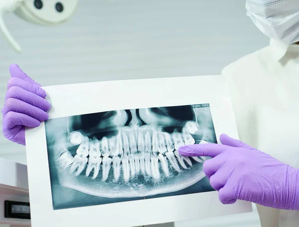 Läkare Tandläkare Lila Gummihandskar Undersöker Tänder Röntgen Stockfoto