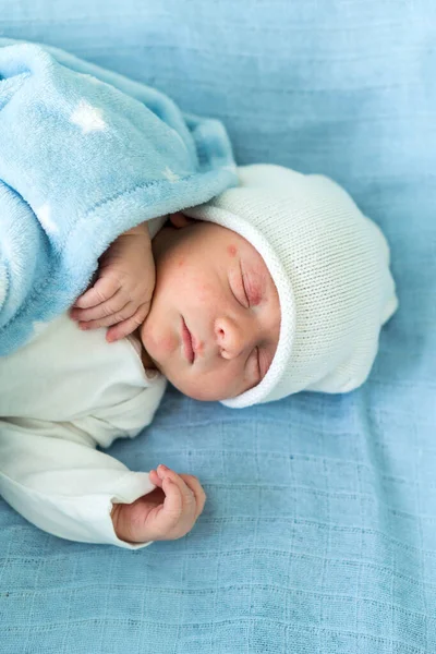 Retrato de rosto bonito vermelho do bebê recém-nascido primeiros dias dormindo na cama de vidro médico no fundo azul. Criança no início minutos de vida no chapéu. Bebês, Parto, Primeiros Momentos de Borning, Princípio de Início — Fotografia de Stock