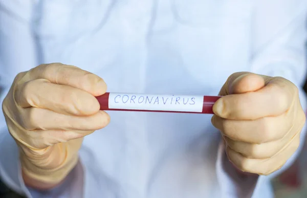 Kezét Olyan Orvosi Kesztyűben Tartja Amely Vérvizsgálati Csövet Tart Coronavirus — Stock Fotó