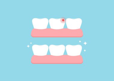 Ağrılı diş, mavi arka planda izole edilmiş sakızla sağlıklı..