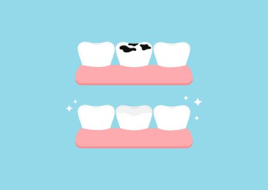 Spor salonundaki çoklu diş ikonu setinden önce ve sonra dişler izole edildi.