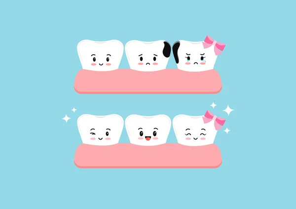 Aranyos fogak előtt és után bomlás torna fogászati gyerekek ikon készlet elszigetelt. — Stock Vector