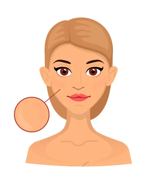 Femme différents types de peau normale, zone élargie pour la cosmétologie. Acné, rides et taches de vieillesse. — Image vectorielle