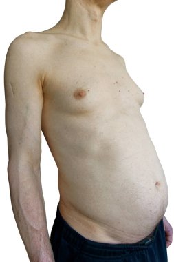 50 'li yaşlarda beyaz bir erkeğin çıplak gövdesi..