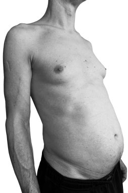 50 'li yaşlarda beyaz bir erkeğin çıplak gövdesi..