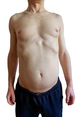 50 'li yaşlarda beyaz bir erkeğin çıplak gövdesi..