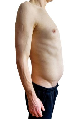 50 'li yaşlarda beyaz bir erkeğin çıplak gövdesi..