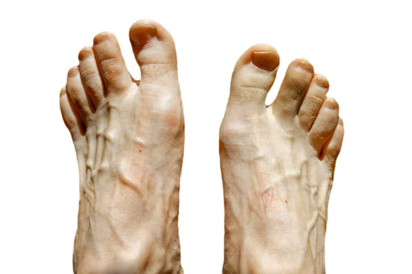 Two feet of a caucasian male