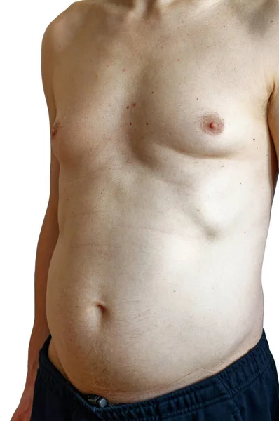 Bare torso of caucasian male at his 50s.