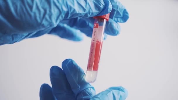 Sang dans un tube médical — Video