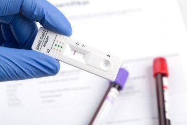 Ekspres korona testi. Negatif covid antijen testi.