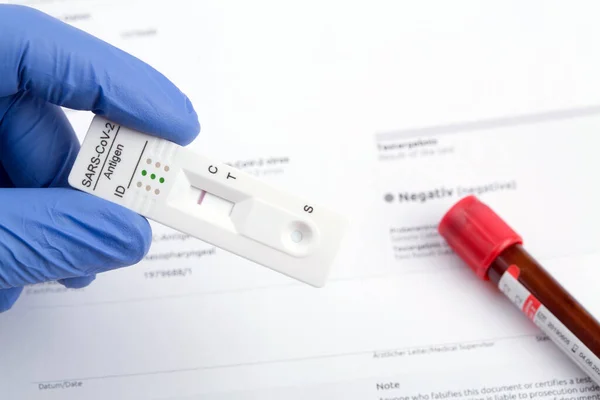 Express corona test. Negative covid antigen test.