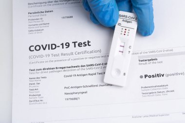 Ekspres korona testi. Pozitif covid antijen testi.