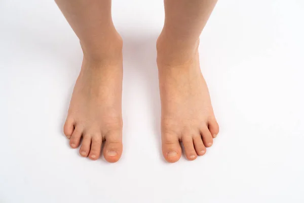 Παιδικά πόδια σε λευκό φόντο, η έννοια της πρόληψης των παιδικών πλατιών ποδιών, valgus του ποδιού Εικόνα Αρχείου