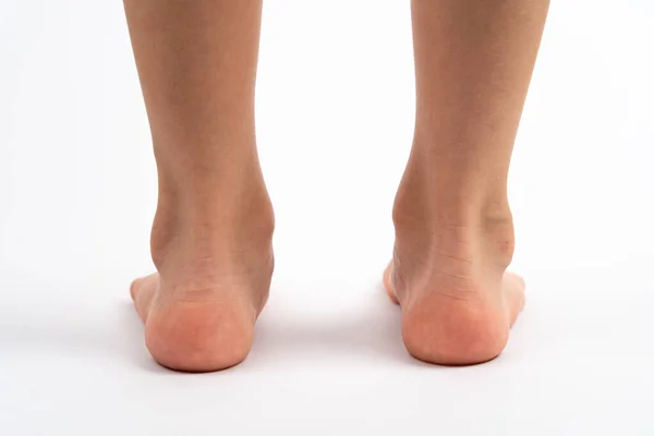 Beyaz arka plan görünümlü çocuklar, düz taban çocukların önlenmesi kavramı, ayak valgus