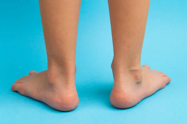 Niños pies sobre un fondo azul vista trasera, el concepto de prevención de los niños pies planos, valgus del pie Imagen De Stock