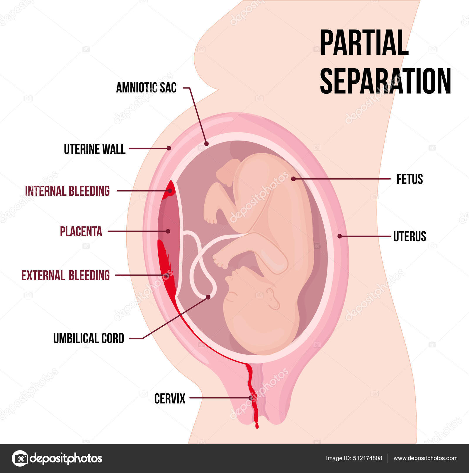Hoppe enn €3000 ble brukt på bandasjer og tourniquets - UA-postkort, image size:1600x1615