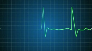 bir Elektrokardiyogram (ekg veya EKG) gösteren zonklayan kalp beat