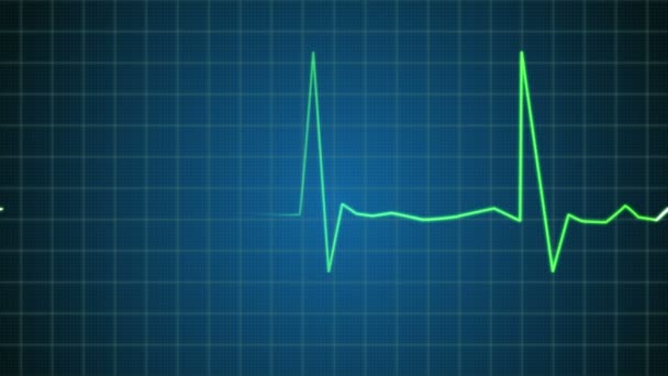 Bir Elektrokardiyogram (ekg veya EKG) gösteren zonklayan kalp beat — Stok video