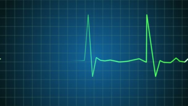 az EKG (ekg és EKG) találat lüktető kandalló beat