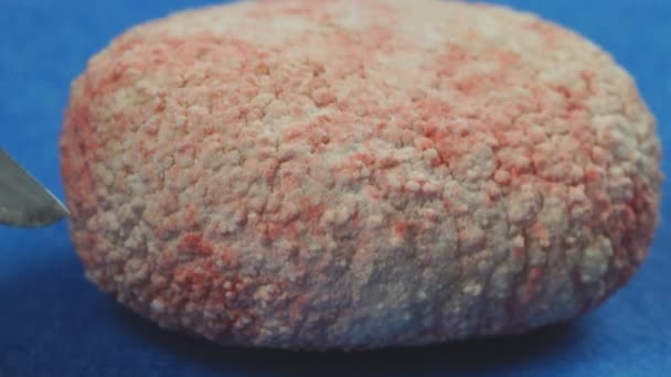 Veterinární lékař odstranění velkých měchýře kámen v pes — Stock video