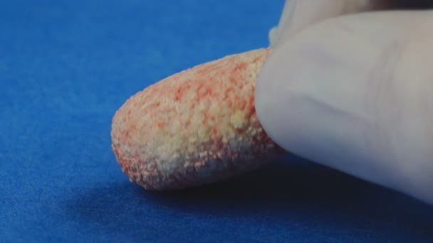 개에 있는 매우 큰 방광 돌을 제거 하는 수 의사 — 비디오