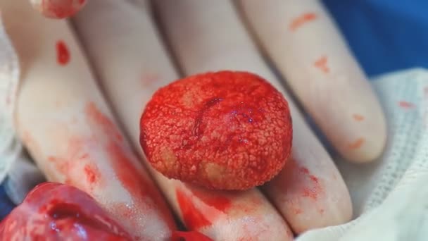 Veterinarian removing several large Bladder stones in a dog. — Stock Video