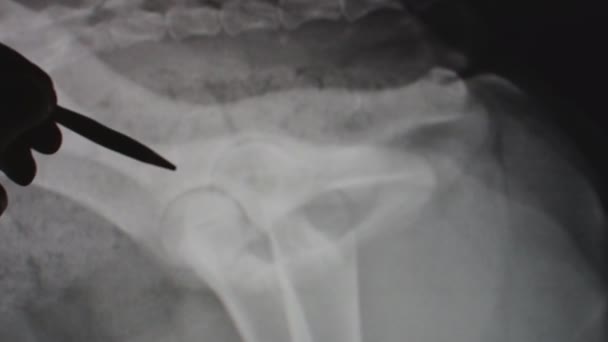 Veterinarian explaining radiograph to a pet owner — Stock Video