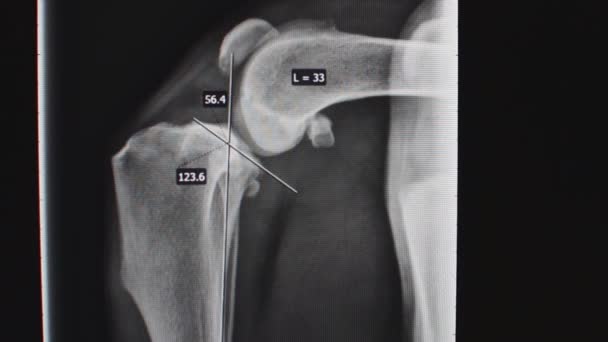 Veterinário explicando radiografia para um proprietário de animal de estimação — Vídeo de Stock