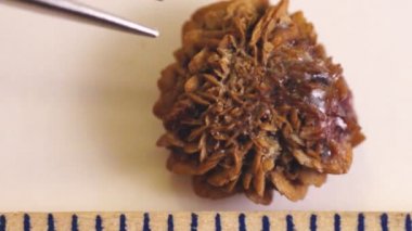 Büyük mesane taşı