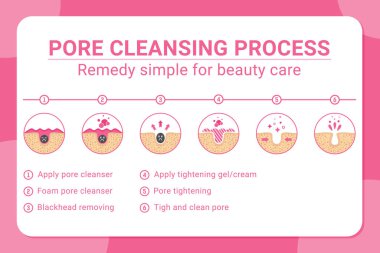 Siyah noktaların kaldırılması ve gözenek temizleme işlemi için 6 numaralı vektör pankartı. Sivilce ya da siyah nokta gözenek temizleme işlemi. İzole edilmiş beyaz arka planda güzellik hizmetleri için basit bir tedavi yöntemi. Cilt bakımı için tasarım