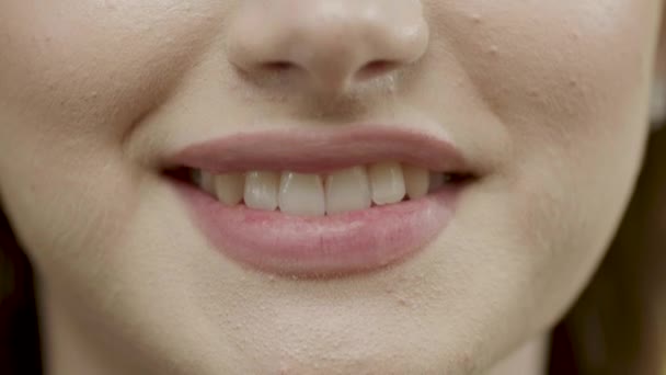 Amplia Sonrisa Una Joven Limpie Los Dientes Después Del Procedimiento — Vídeos de Stock