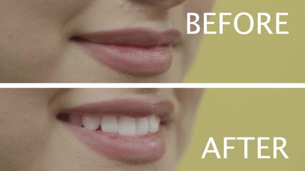 Concept Soins Dentaires Dentisterie Gros Plan Une Heureuse Femme Caucasienne — Video