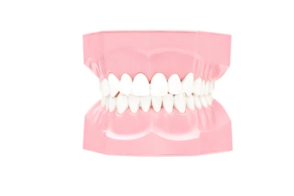 Dentaduras feitas de gesso — Fotografia de Stock