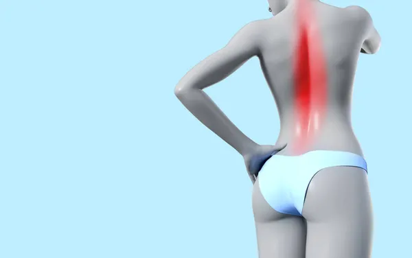 Render Illustration Female Figure Standing Infammated Spine Area Blue Background — Stock Photo, Image