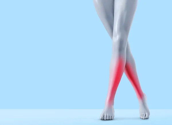Darstellung Weiblicher Beine Mit Schienbeinschmerzen Auf Blauem Hintergrund — Stockfoto