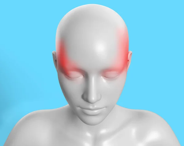 Renderowania Ilustracji Grafiki Kobiety Szarej Postaci Migreną Ból Niebieskim Tle — Zdjęcie stockowe