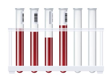 Kan şişesi, plazma gerçekçi test tüpü plastik veya bilim ve bebek bağışları için cam şişeleri.