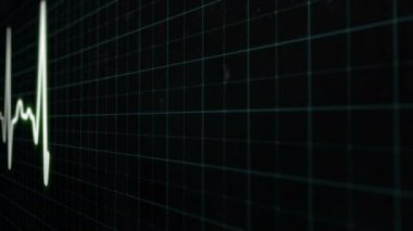 Kalp atış hızı monitörü elektrokardiyogram tıbbi monitörü