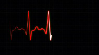 Şebeke çizgileriyle monitörde eş zamanlı kalp atış hızı