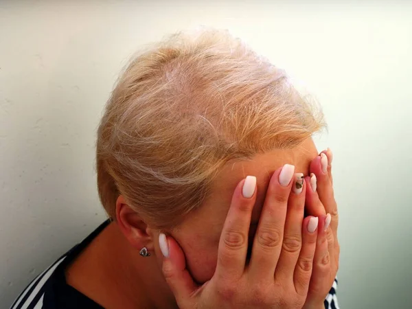 emotional pose of a white woman with hands covering her face, stress due to loss of hair in women, worries about a woman\'s baldness, balding blonde head