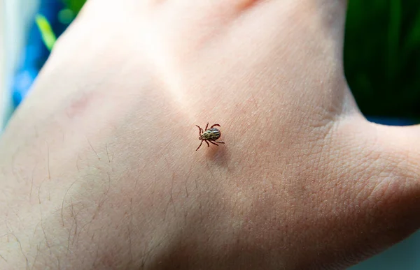 Infected dangerous biting Tick on human skin - carrier of infection and viruses. Ixodus ricinus. Parasitic tick.