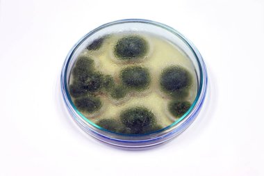 Malt Extract Agar medyasında penisilyum artışı, tıbbi sağlık laboratuvarı analizinde maya, küf ve mantar testleri klinik örneklerini izole etmek ve yetiştirmek için petri kabı kullanımı ile büyür..