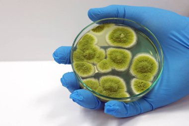 Malt Extract Agar 'da penisilyum, elinde Petri kabıyla yetişir. Tıbbi sağlık laboratuvarı hastalıklarında maya, mantar ve mantar örneklerini izole etmek için nitrile eldiven giyer..