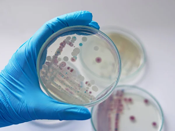 Investigador Sostiene Placa Petri Vibrio Vulnificus Chromagar Tcbs Una Bacteria Imagen de archivo