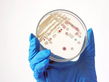 Araştırmacılar, istiridye gibi filtre ile beslenen yumuşakça kabuklu deniz ürünlerinde bulunan bir estuarin bakterisi olan CHROMagar ve TCBS 'de, Vibrio vulnificus Petri kabını tutuyor..