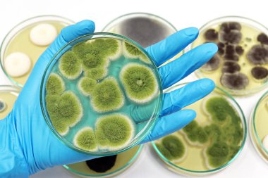 Bilim adamı, Malt Extract Agar medyasında mantar, siyah küf ve mantar klinik testlerini tıbbi sağlık laboratuvarı analizinde kullanmak üzere petri kabıyla birlikte Penisilyum üssünü izole etti..