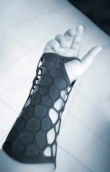 Protesi plastica ortopedica nera stampata su stampante 3D a portata di mano. — Foto Stock
