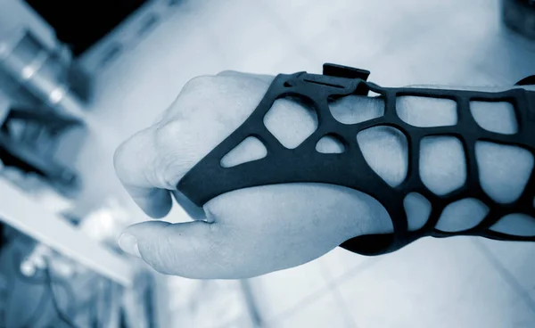 Protesi plastica ortopedica nera stampata su stampante 3D a portata di mano. — Foto Stock